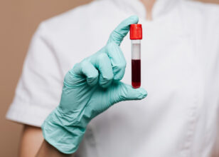 What you Should Know About Blood Infection?