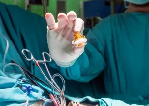Face Danger Zones: Understanding the Risks of Surgery, Fillers, and Non-Invasive Devices