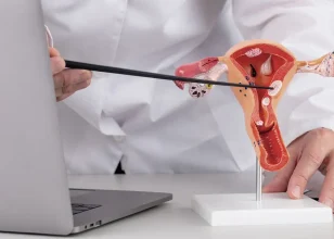 Treatment and Diagnosis of Rare Gynaecologic Cancers