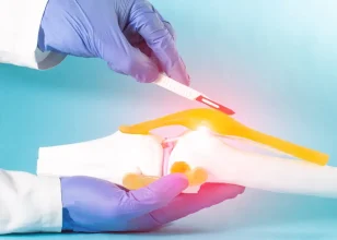 Knee Arthroscopy: Diagnosis and Treatment