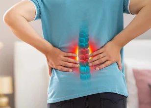Artificial Disk Replacement for Lumbar Spine Back Pain