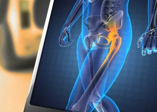 Explore Anesthesia Choices for Hip and Knee Surgery